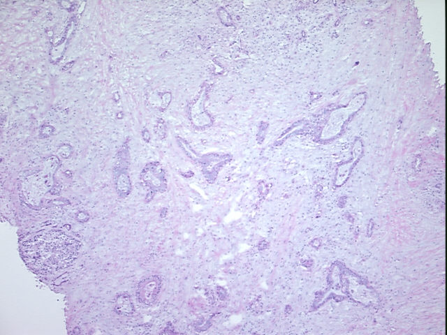 4x Image