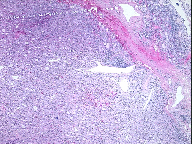 4x Image