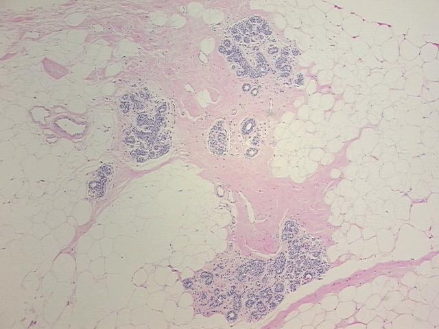 4x Image
