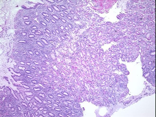 4x Image