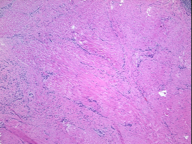 4x Image