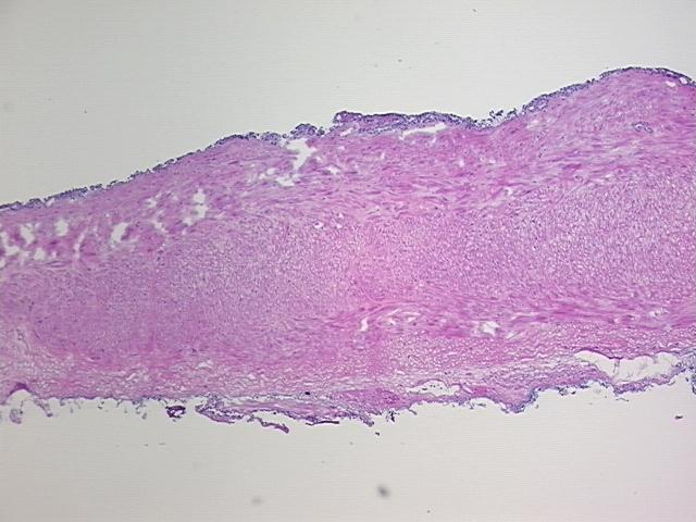 4x Image