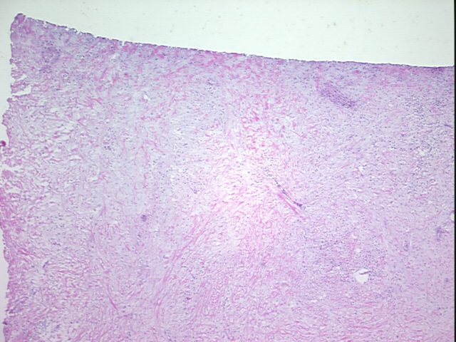 4x Image