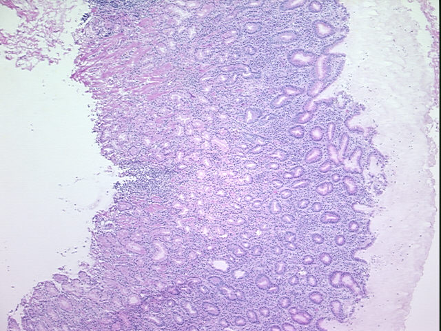4x Image