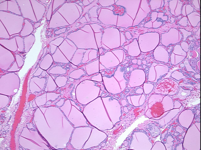 4x Image