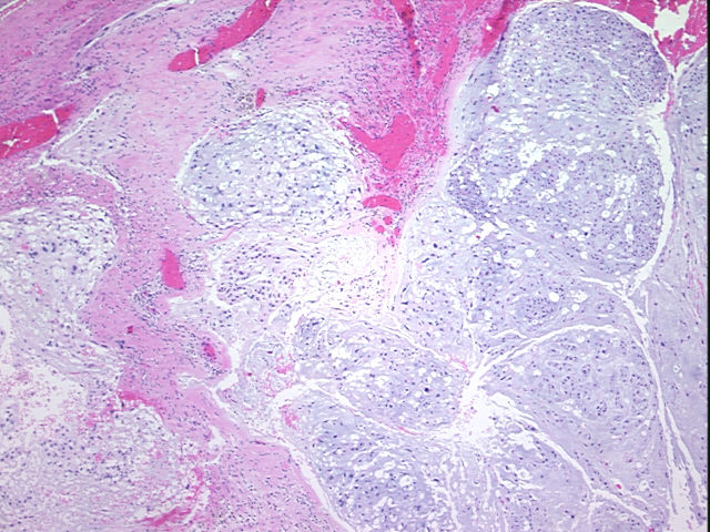 4x Image