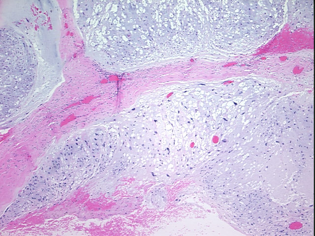 4x Image