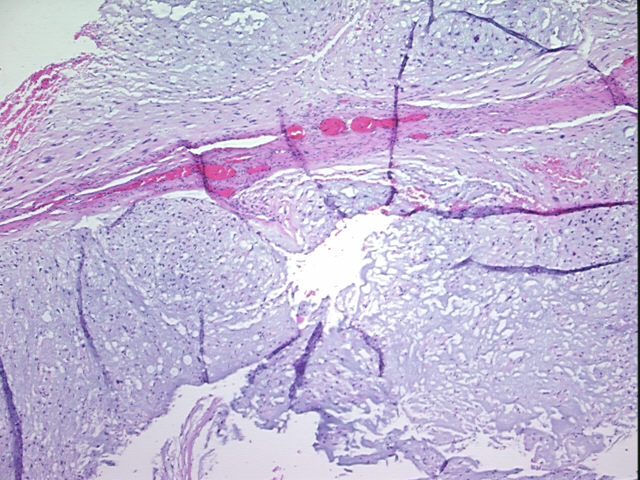 4x Image
