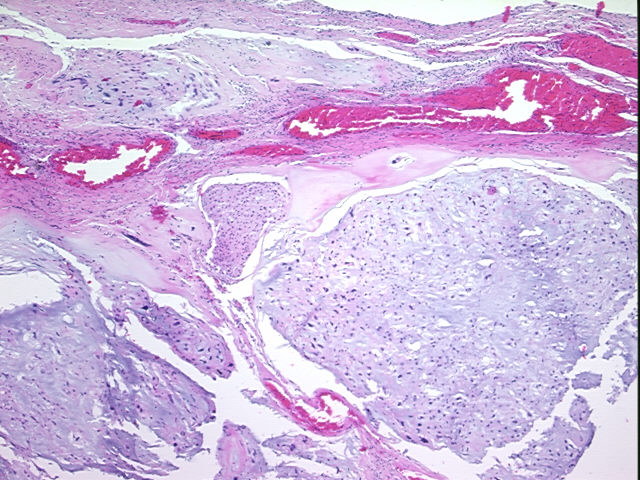4x Image