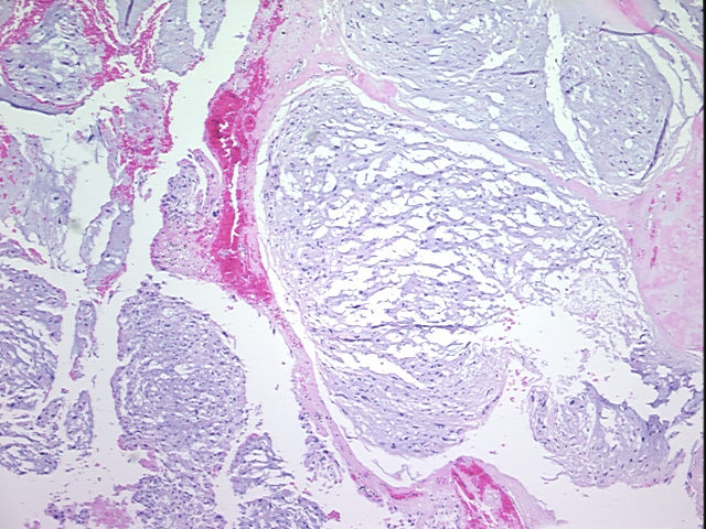 4x Image