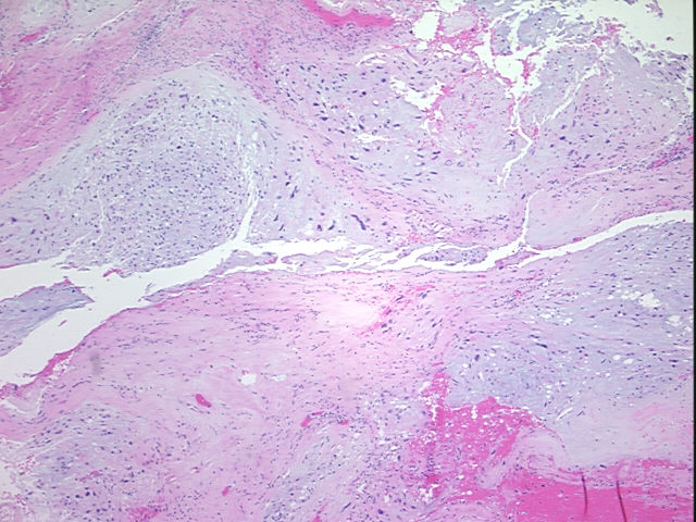 4x Image