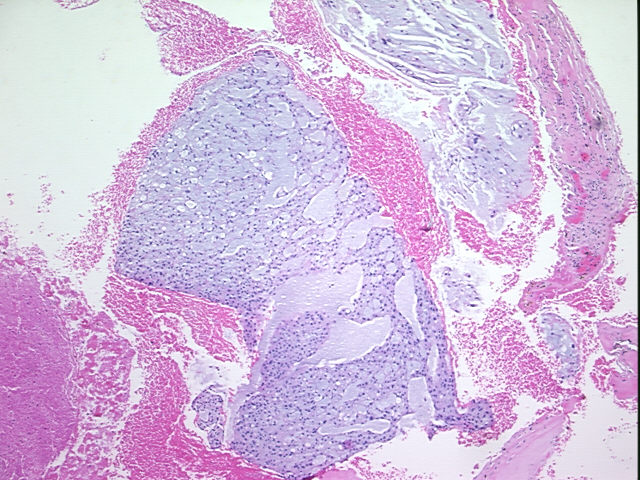 4x Image