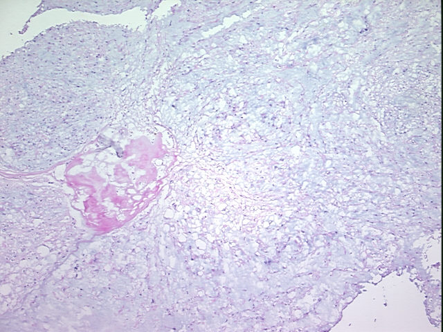 4x Image