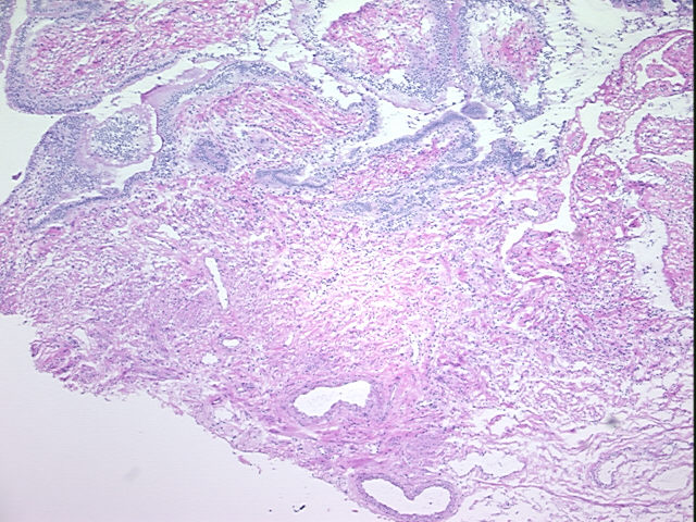 4x Image