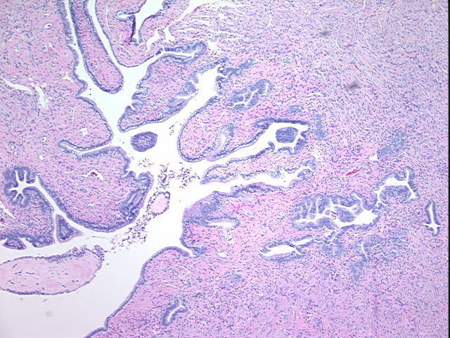 4x Image