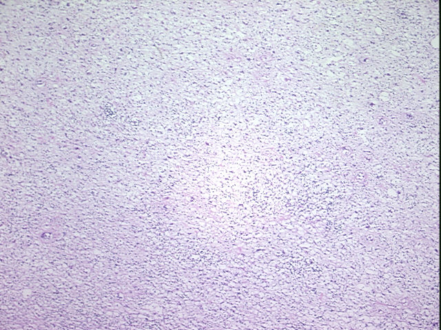 4x Image