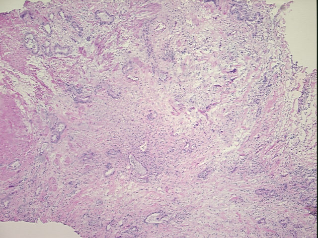 4x Image