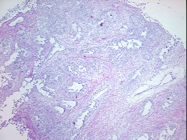 4x Image