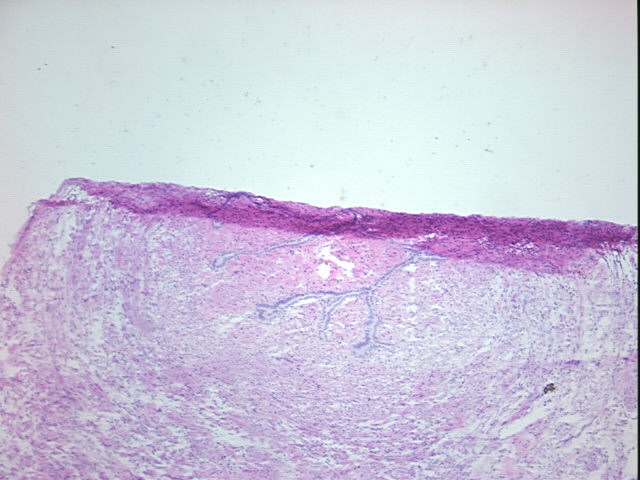 4x Image