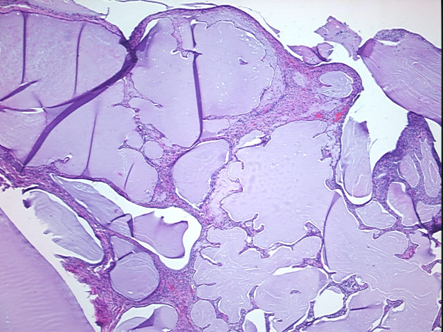 4x Image