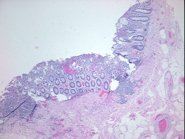 4x Image