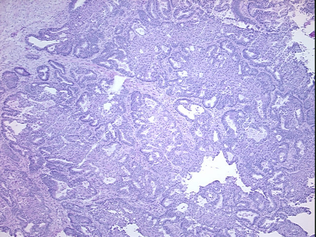 4x Image