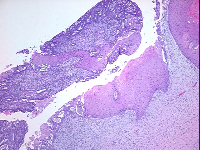 4x Image