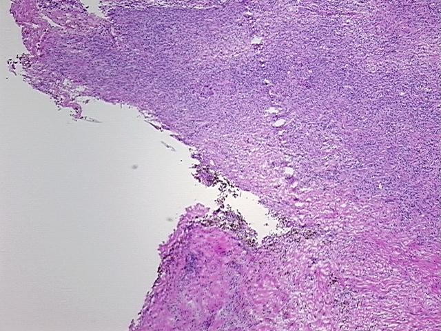 4x Image