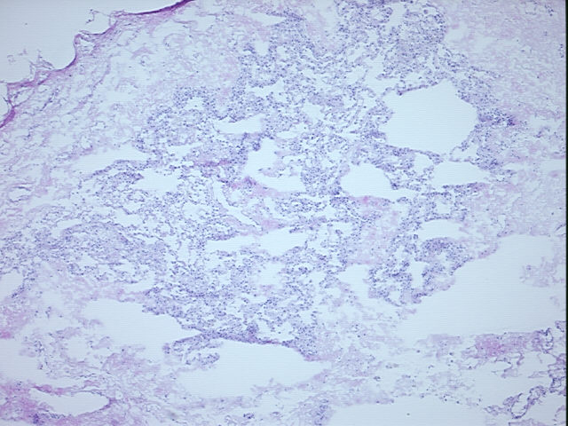 4x Image