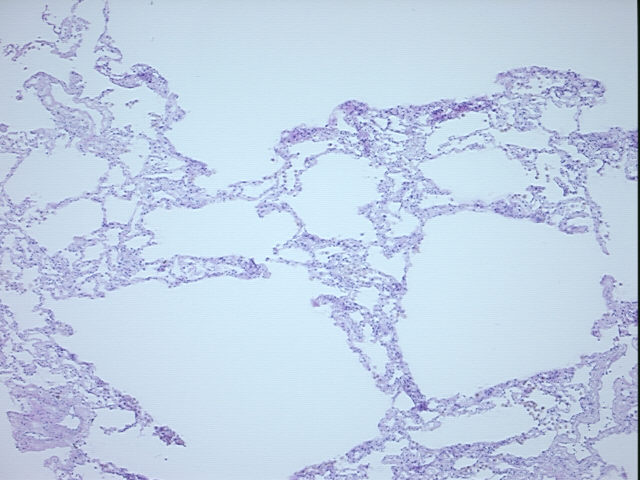 4x Image