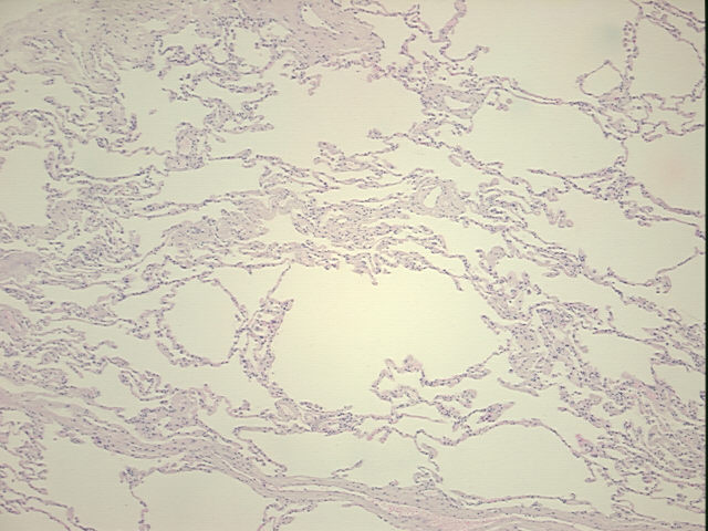 4x Image