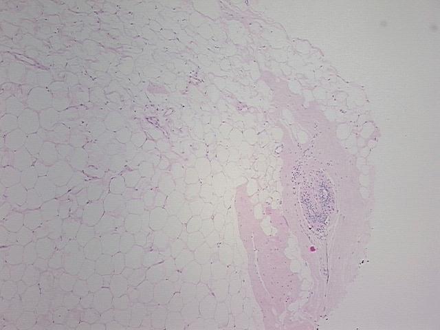 4x Image