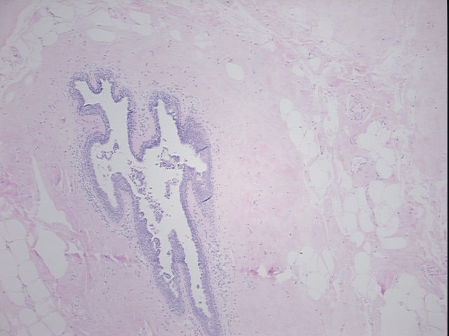 4x Image