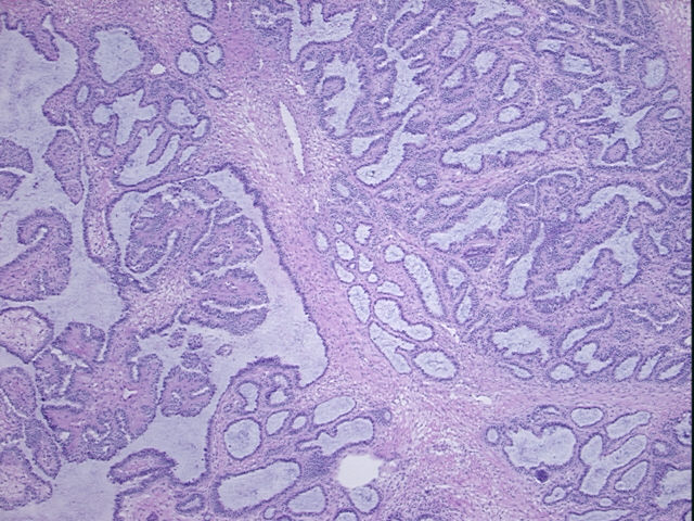 4x Image