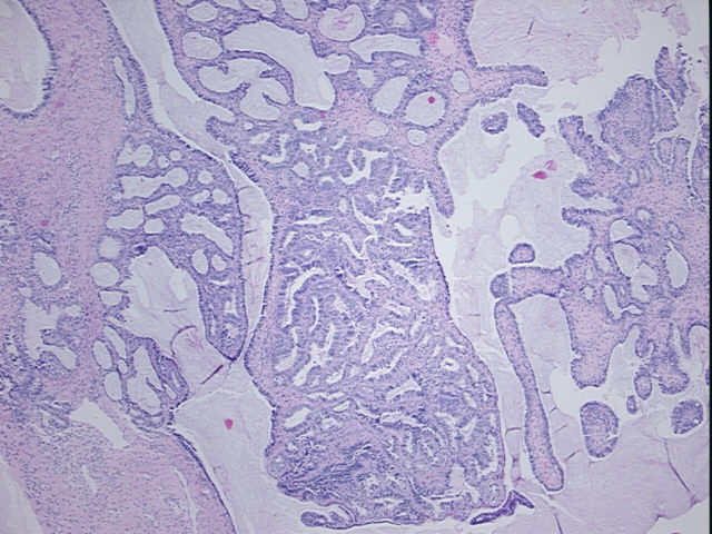 4x Image