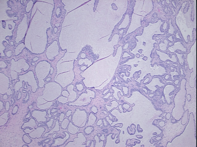 4x Image