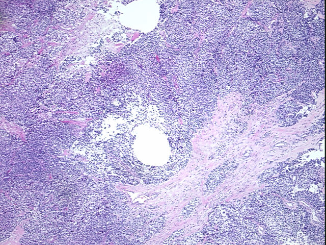 4x Image