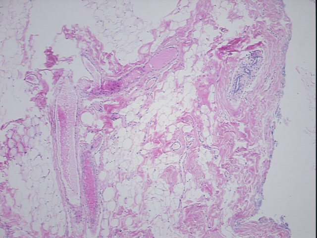 4x Image