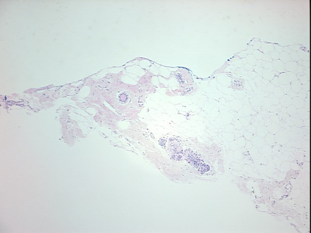 4x Image