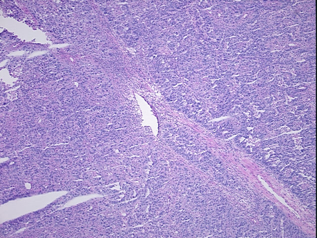 4x Image