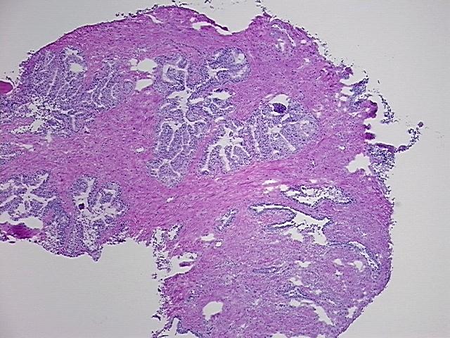 4x Image
