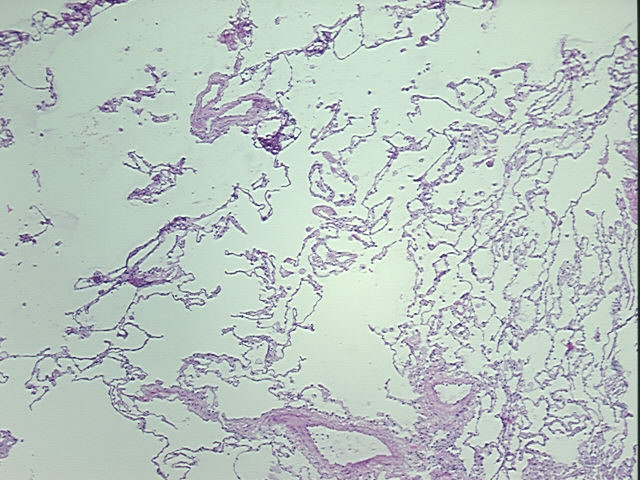 4x Image