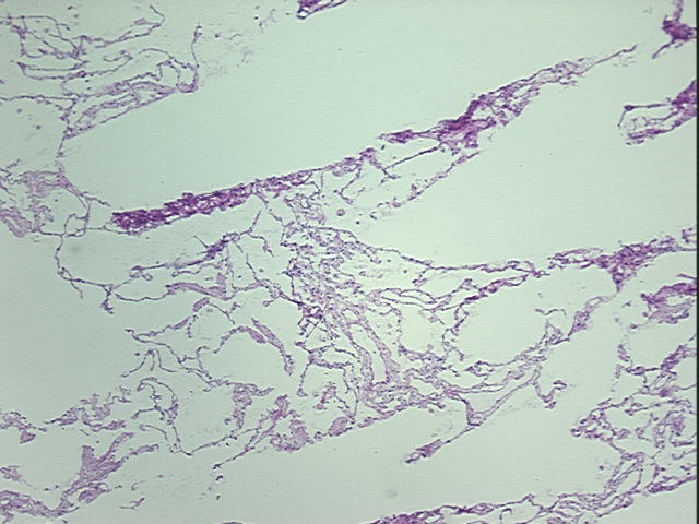 4x Image