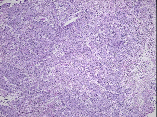 4x Image