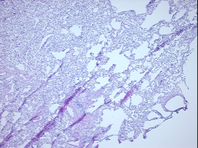 4x Image