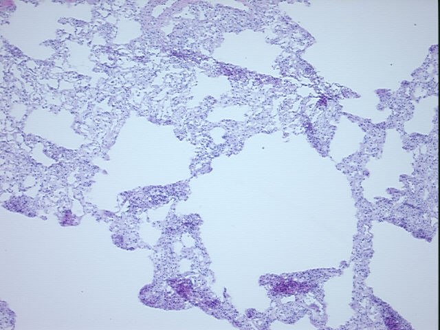 4x Image