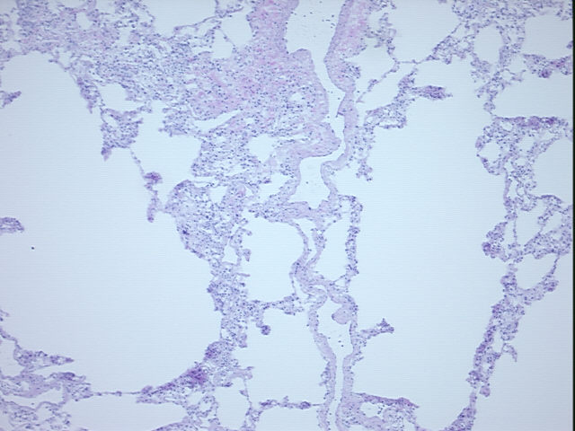 4x Image