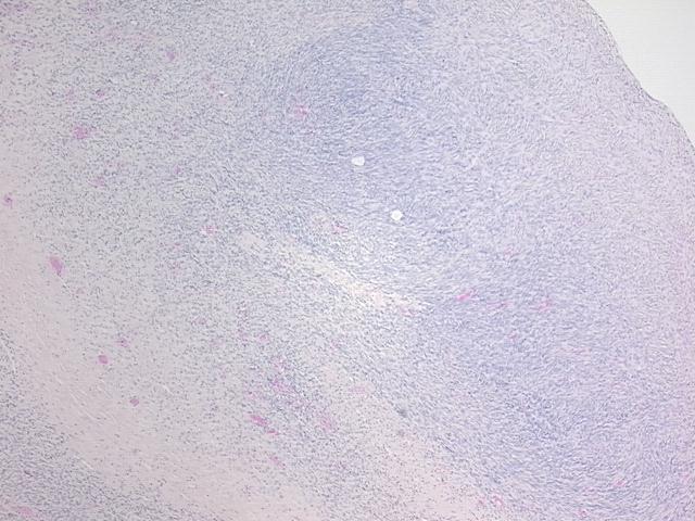 4x Image