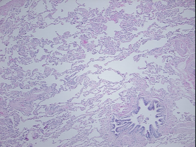 4x Image