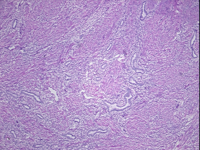 4x Image